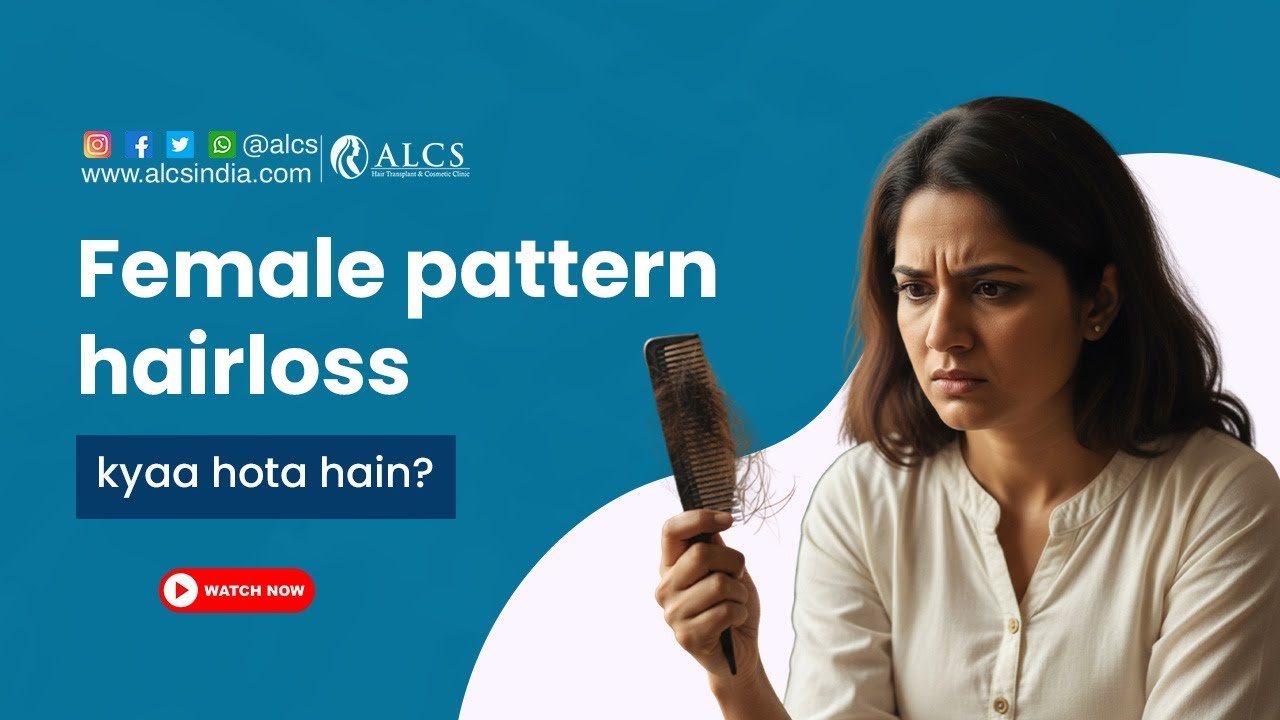 Causes of female pattern baldness | Dr. Sunil Arora | ALCS Jaipur