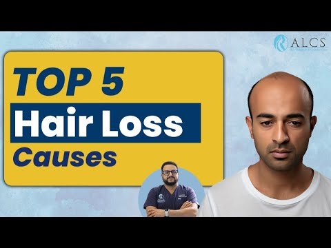 Top 5 Reasons for Hair Fall Explained by Dr. Sunil Arora | ALCS Clinic