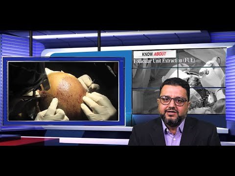 FUE Technique - FAQ Answered By The Best Hair Transplant Surgeon - Dr Sunil Arora