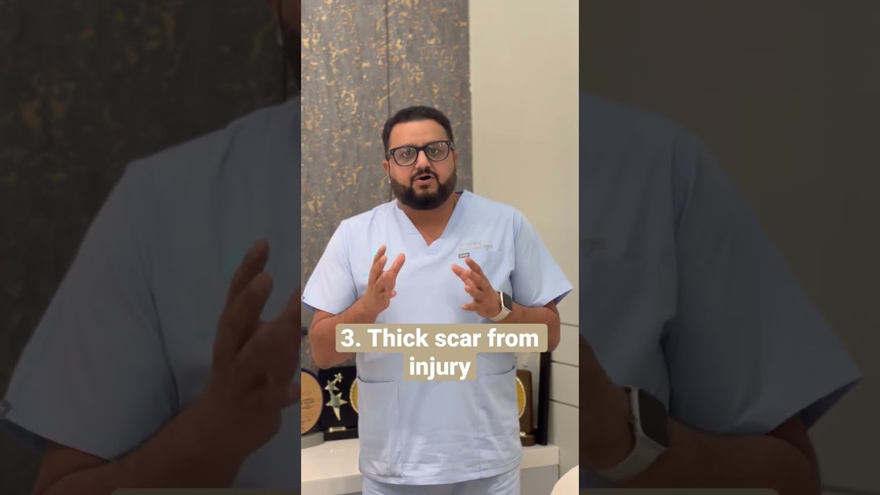 Do you really need a Hair Transplant? -Dr. Sunil Arora