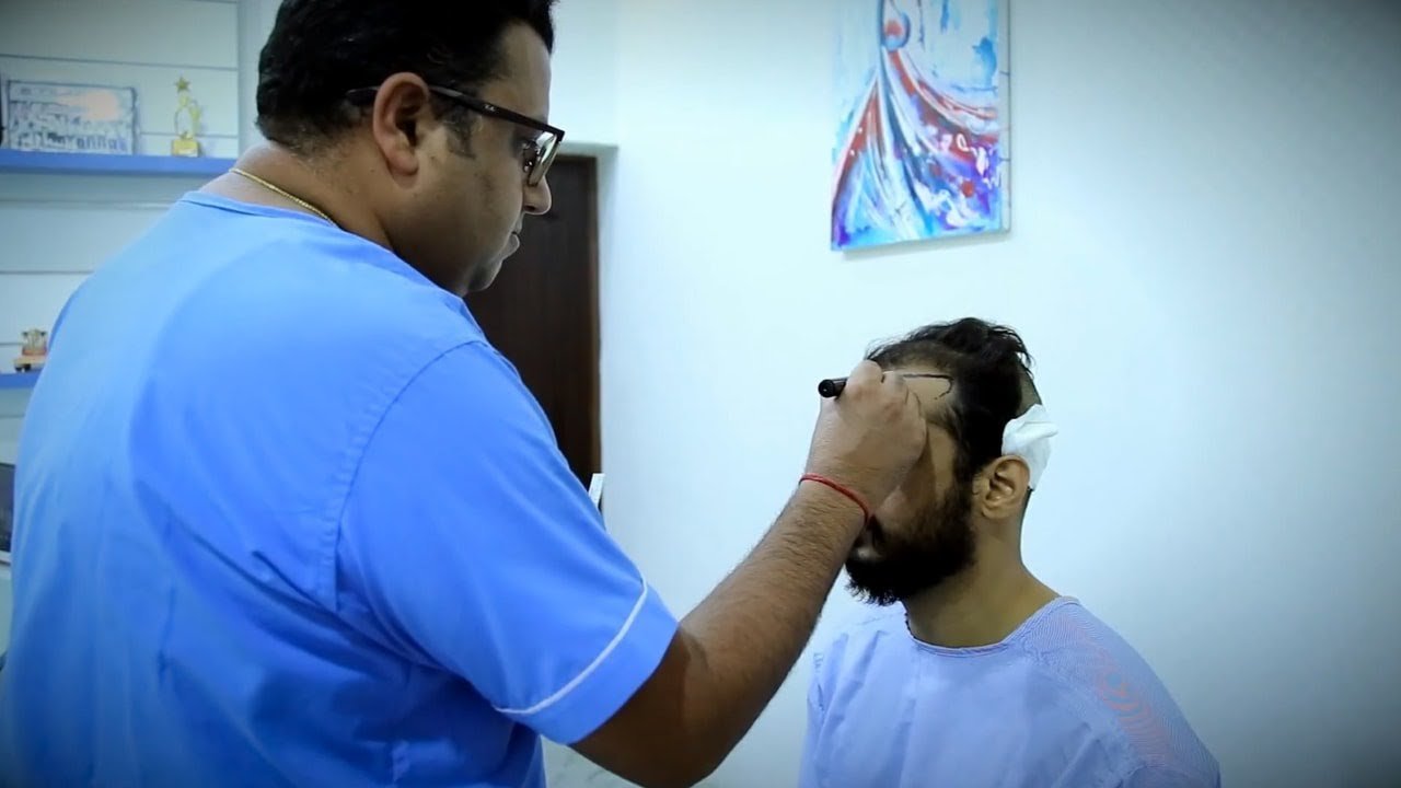 Hairline Reconstruction at ALCS - Dr. Sunil Arora | Best Hair Transplant in Jaipur - India