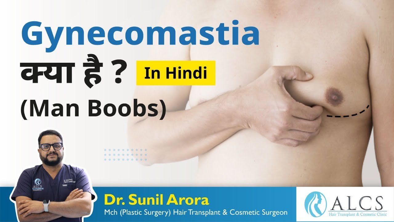 Gynecomastia क्या है ? | Male Boobs |  Dr Sunil Arora | ALCS Clinic Jaipur