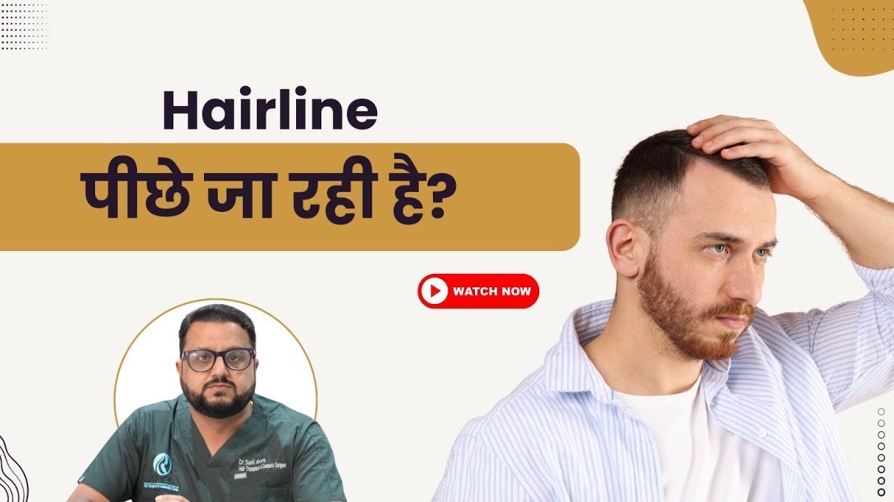 Receding Hairline शुरू हो गई है? जानिए Early Signs with Dr. Sunil!