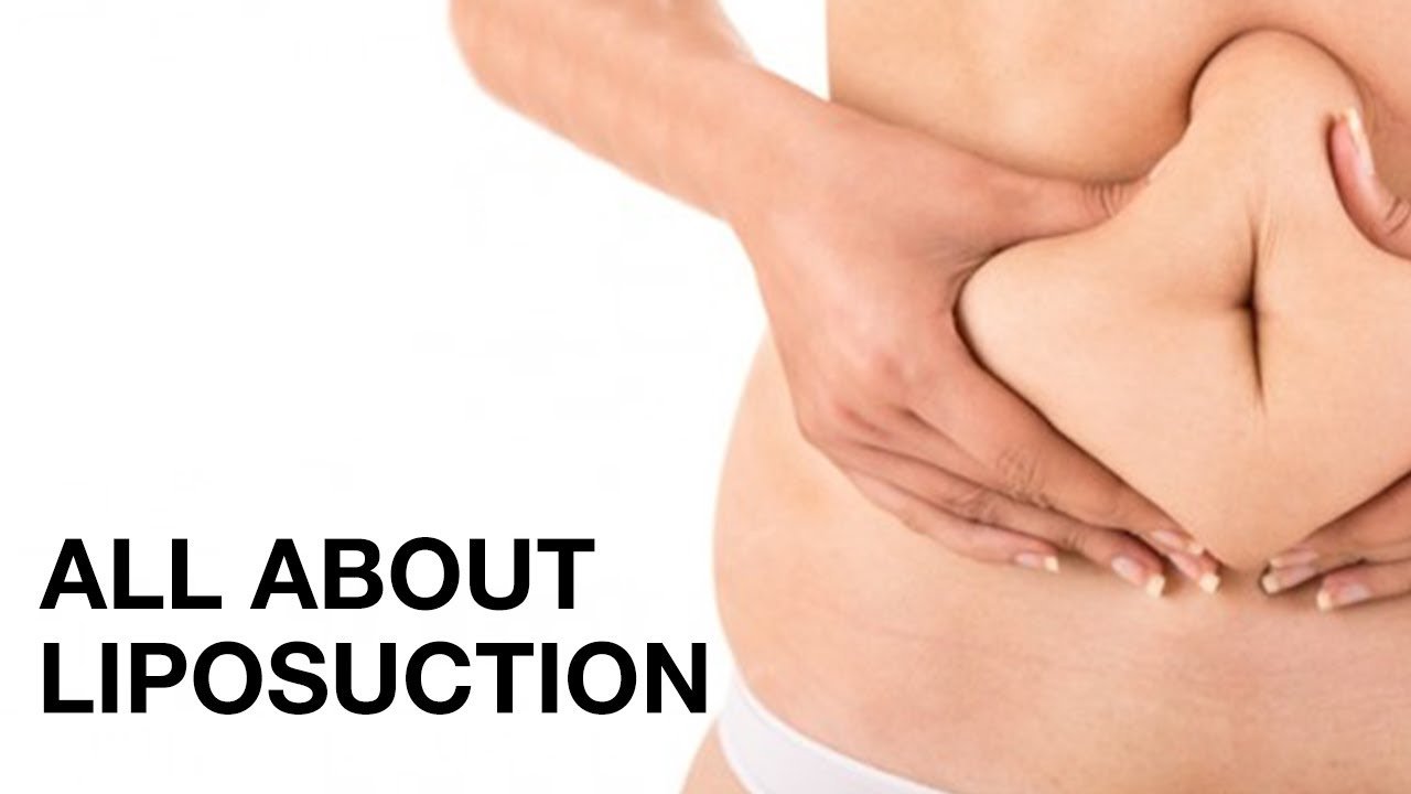 Liposuction Fat Removal : Everything You Need to Know About It | Liposuction In Jaipur