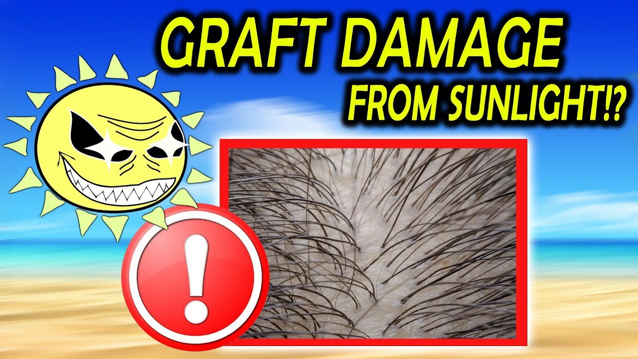 Hair Graft Damage from Sunlight!!! Real or Not!?